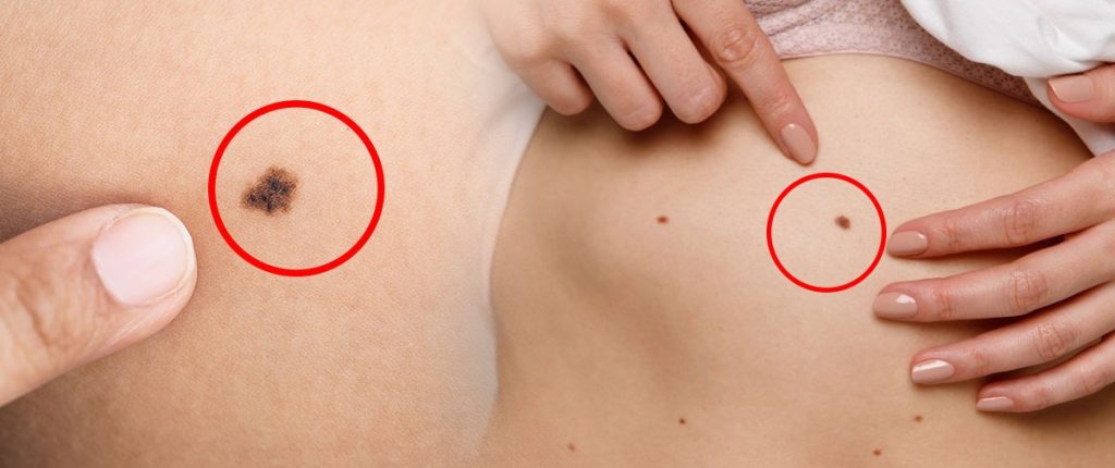 ඉපැරණි ග්‍රන්ථයකින් උපුටාගත් උපන් ලප වලින් කියවෙන අනාවැකි රැසක් මෙන්න.