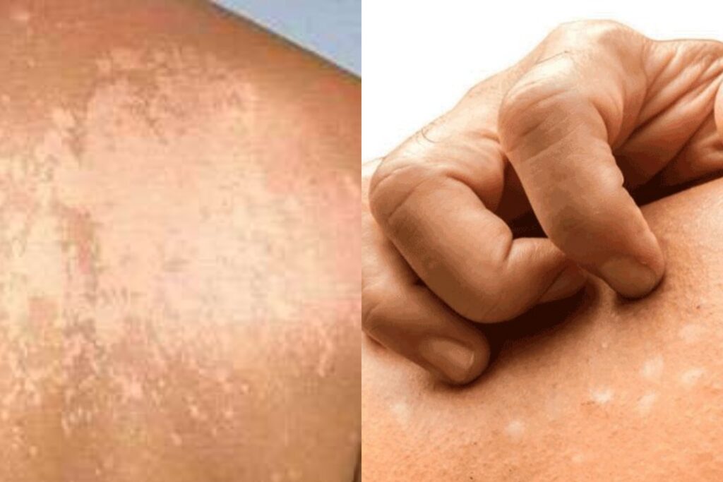 ඔබත් මේ දේවල් නිසා පීඩා විදිනවා නම් මෙන්න එය සුව කරගන්න හොදම ක්රමය.