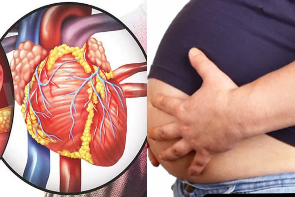 කොලෙස්ටරෝල් අඩු කරන , කෙට්ටු වෙන්න ගෙදරදීම සාදාගත හැකි විශ්මිත පානයක් මෙන්න.