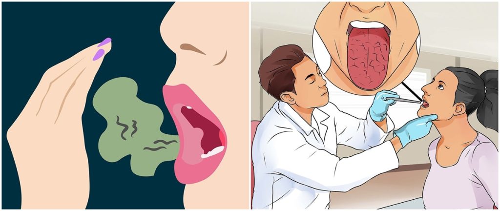 මුඛයෙන් පිටවෙන අධික දුර්ගන්ධය සහ බැක්ටීරියා ඉවත් කරන සුපිරි ක්රම 07ක් මෙන්න.