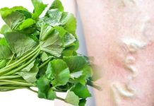 අත්දුටුයි ප්රත්යක්ෂයි…නහර ගැට ගැසීම වලකන දිව ඔසුව මෙන්න…