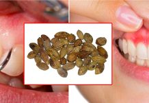 දත් මුල් දියවීම වලක්වා ගන්න ගෙදරදීම සදා ගත හැකි සුපිරි බෙහෙතක් මෙන්න