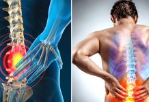 කොන්දේ කැක්කුම ඉක්මණින් සුවකරන ක්රම ටිකක් මෙන්න