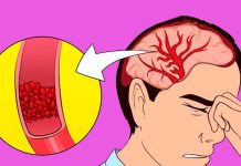 නිතරම ඔලුව රිදෙනවද? තෙහෙට්ටුවද? නින්ද අඩුද? මෙන්න විසඳුම..