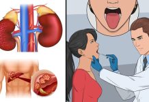 ඔබේ මුඛයෙන් හමන හුස්මෙහි ගන්ධය මඟින් හෙළි කළ හැකි සෞඛ්ය තත්වයන්.