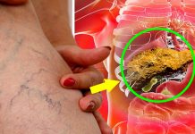 වේගයෙන් අක්මාවේ තෙල් තැන්පත් වී ඇති බව කල්තියා පෙන්නුම් කරන ලක්ෂණ 12 ක්