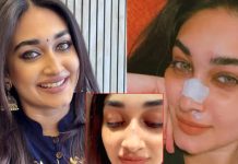 ”රටම දන්නවා මගෙ නහයෙ පොඩි තුවාලයක් වුණා කියලා. ඇත්තටම මම වැටුණා. තුවාලෙ කැළල තවම තියෙනවා…” – දේශානි නෙහාරා |