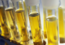 මුත්රාවල වර්ණයෙන් කියවෙන සැඟවුණු ලෙඩ රෝග මොනවාද..? ඔබ නොදන්නා ලෙඩරෝග රැසක් ගැන මෙන්න දැනගන්න..