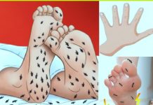 කකුලේ කූඹින් දුවනවා වගේ දැනෙනවද ? එහෙනම් බලාගෙන ඉන්න එපා….