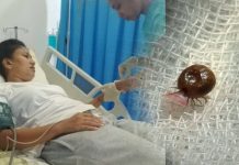 “ඒක ඇත්තටම වචනවලින් විස්තර කරන්න පුළුවන් වේදනාවක් නෙවෙයි.. මගේ ජීවිත කාලය තුළ මං අත්වින්ද බරපතලම භයානකම වේදනාව ඒක..” ඇස් අදහාගන්න බැරි සිද්ධියක් ගැන සුලෝචනා කියූ ඒ කතාව මෙන්න..