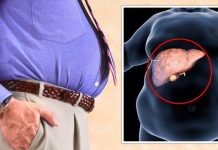 ඔයත් තෙල් කෑම වැඩිපුර කන කෙනෙක්ද ? එහෙනම් අක්මාවේ මේදය තැම්පත් වීම වළක්වා ගන්න මේ කෑම වැඩිපුර කන්න.