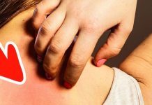 90% ම නොසලකා හරින පි.ළිකා රෝගයේ රෝග ලක්ෂණ 7 ක් මෙන්න.