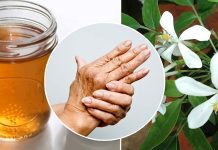 ආතරයිටිස් රෝගය නිට්ටාවටම සුව කරන බිං කොහොඹ කසාය මෙන්න.