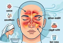 නිතරම නළල හිරකරලා අල්ලනවා වගේ දැනෙන හිසරදයෙන් ඔයත් පීඩා විඳිනවද?