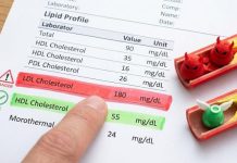 ඩොක්ටර් කෙනෙක් නැතුව Blood Report කියවගන්නේ කොහොමද?