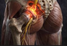 තට්ටම්වල සිට කකූල් දෙසට කරන්ට් එකක් යනවා වගේ වේදනාවක් ඔයාටන් තියෙනවද?