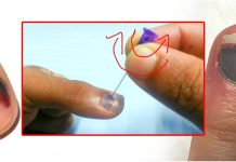 තැලුණු නිය පොත්ත වේදනාකාරීද? කළු වෙලාද? මෙන්න ඒ වේදනාව නැති කරගන්න පහසු ක්රමයක් දන්නවද ?