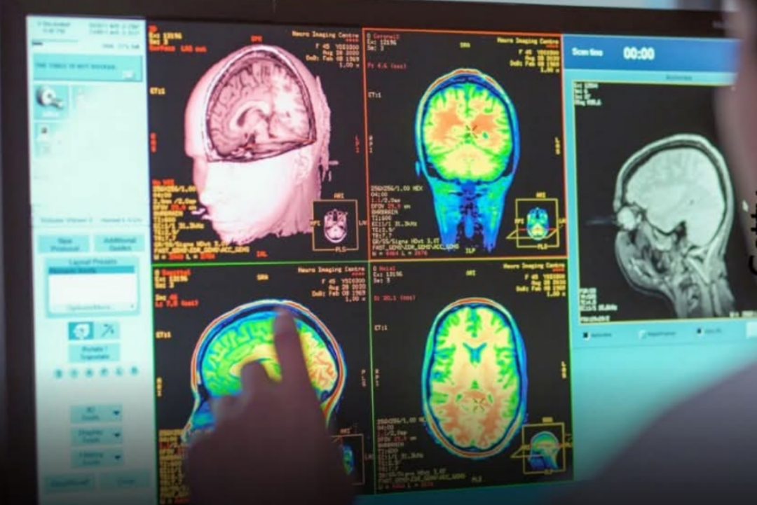 නව යොවුන් විය අවුරුදු 30 දක්වා පවතිනවාලු.. ලොවක් පුදුම කරමින් සොයාගත් ඇස් උඩ යන නව සොයාගැනීමක් මෙන්න…