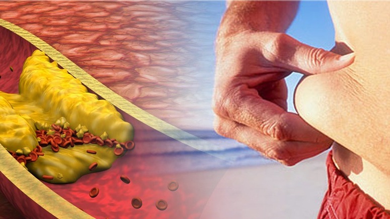 කොලෙස්ටරෝල් වලින් බේරෙන්න මෙන්න ක්රමේ.