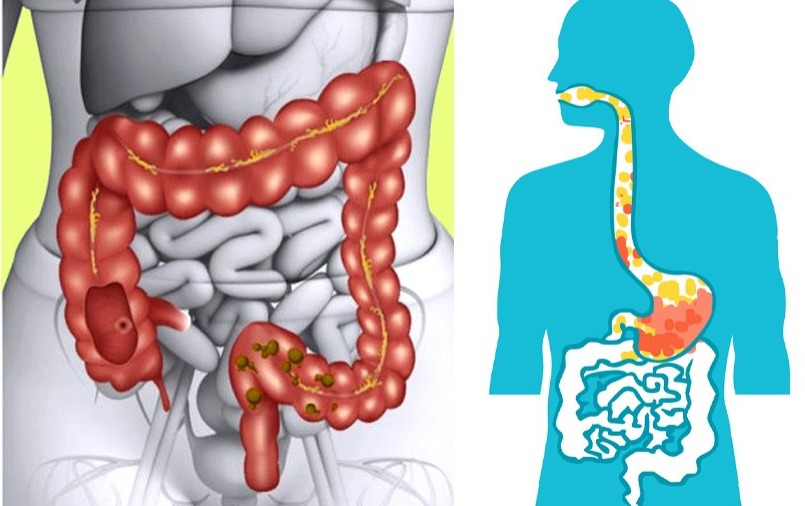 මුළු ශරීරයේම විෂබීජ ඉවත්කර සිරුර පිරිසිදු කරන මේ ආහාර 10 දිනපතා ගන්න